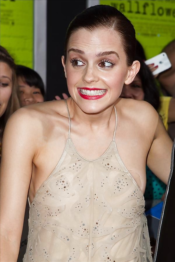 Emma Watson Garderobenfehlfunktion #34851469