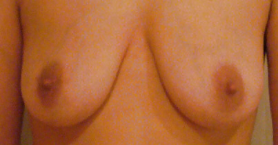 My tits... #25992699