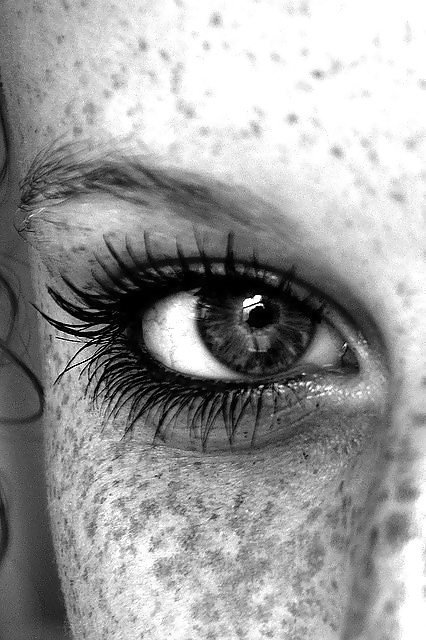 Just freckles....
 #27140228