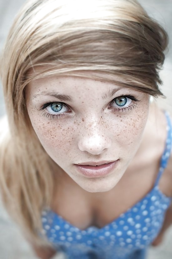 Just freckles....
 #27140240