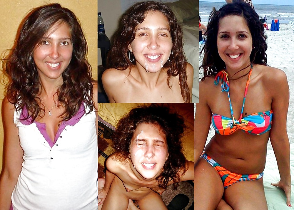 Before-After Facials #34694448