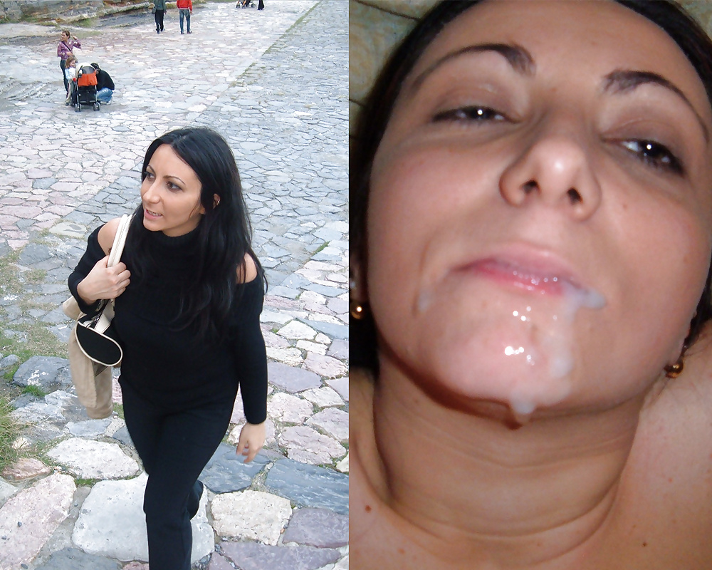 Antes y después de faciales
 #34694456