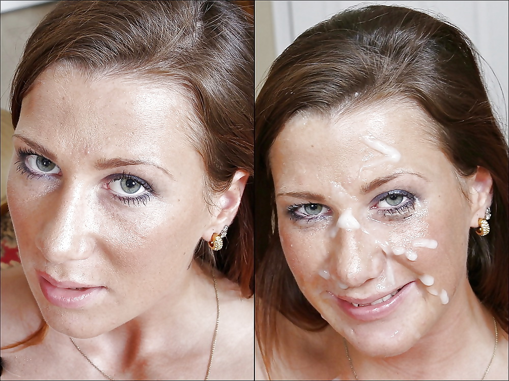 Antes y después de faciales
 #34694544