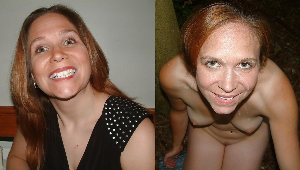 Antes y después de faciales
 #34694554