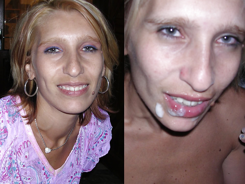 Before-After Facials #34694570