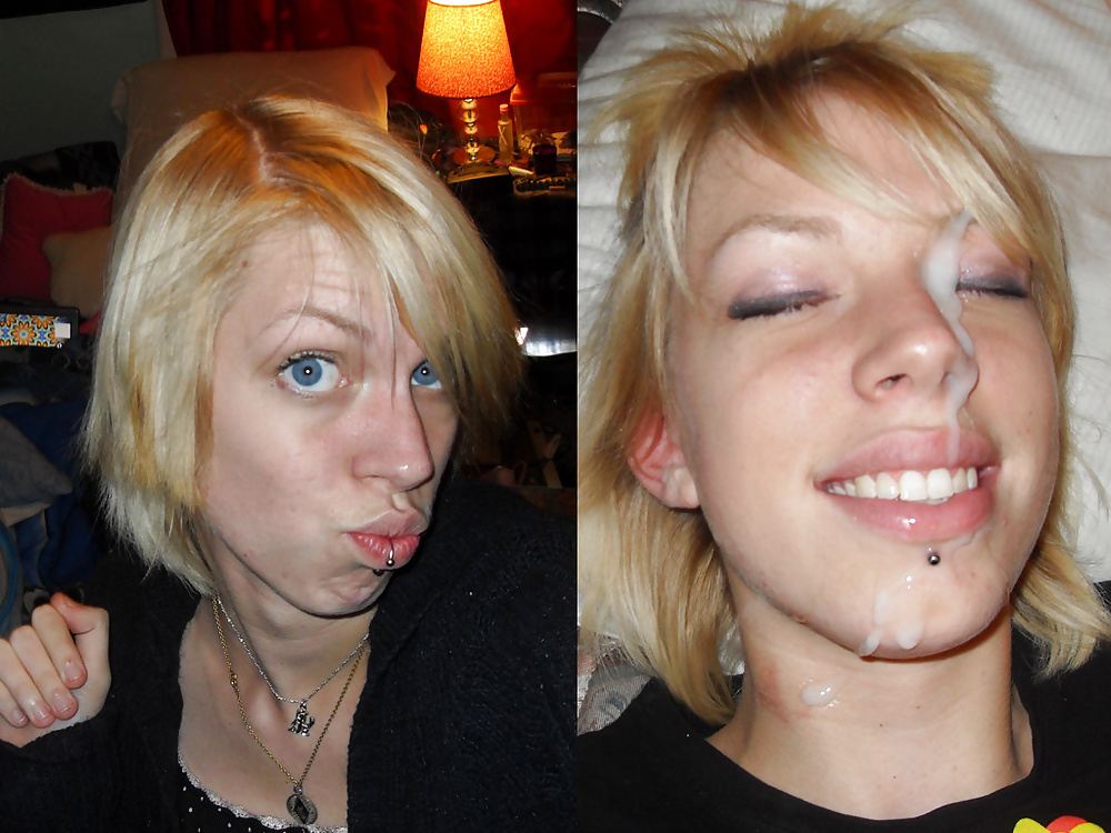 Antes y después de faciales
 #34694574