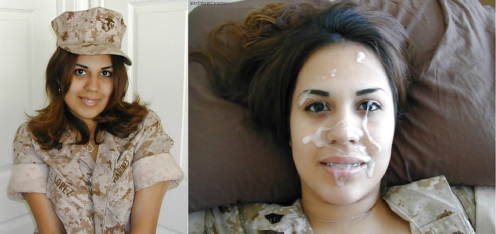 Antes y después de faciales
 #34694583
