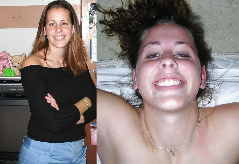Antes y después de faciales
 #34694642