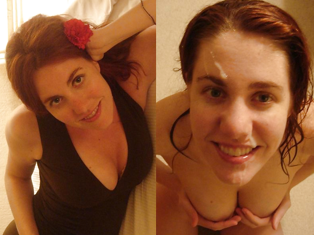 Antes y después de faciales
 #34694659