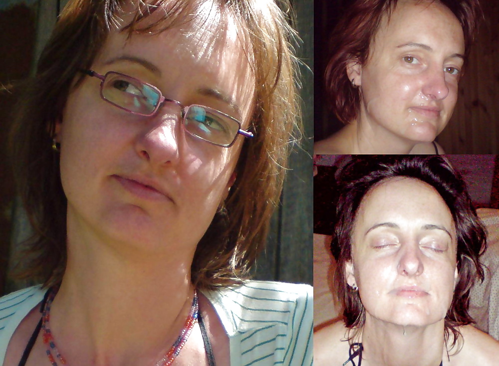 Antes y después de faciales
 #34694662