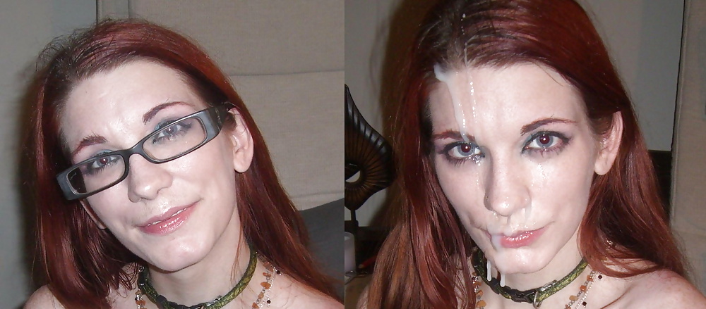 Before-After Facials #34694676