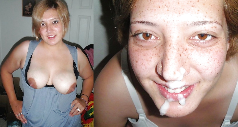 Antes y después de faciales
 #34694693
