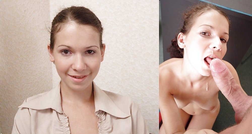 Antes y después de faciales
 #34694697
