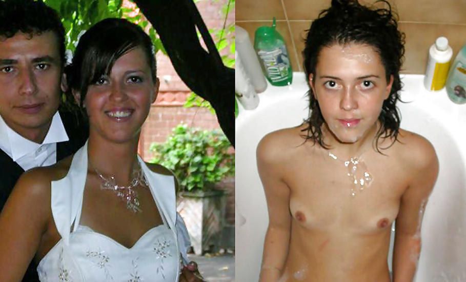 Antes y después de faciales
 #34694711