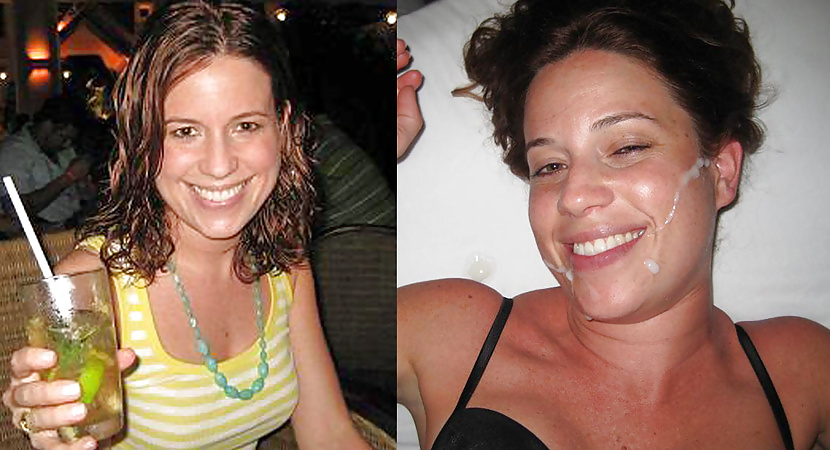 Antes y después de faciales
 #34694723