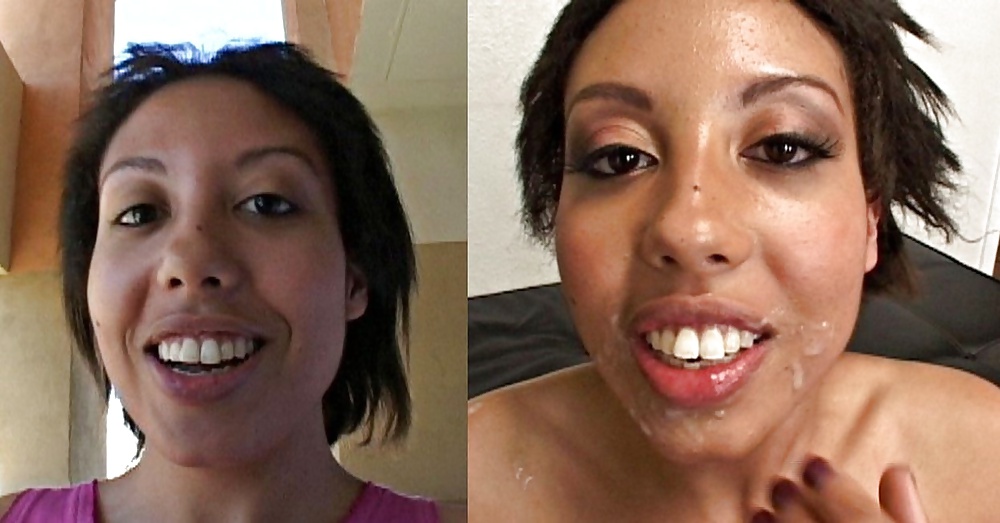 Antes y después de faciales
 #34694740