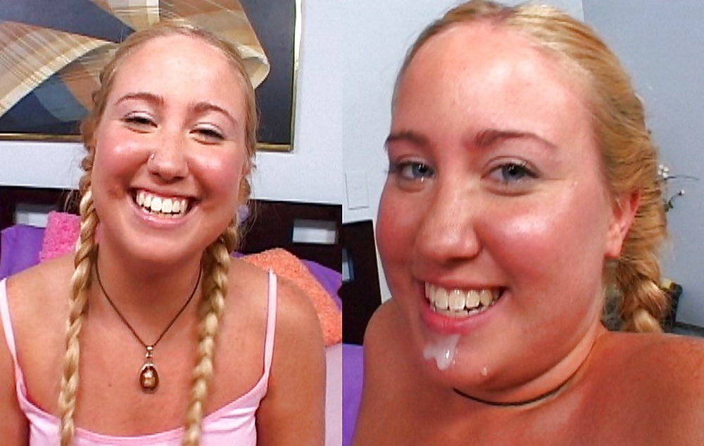 Before-After Facials #34694748