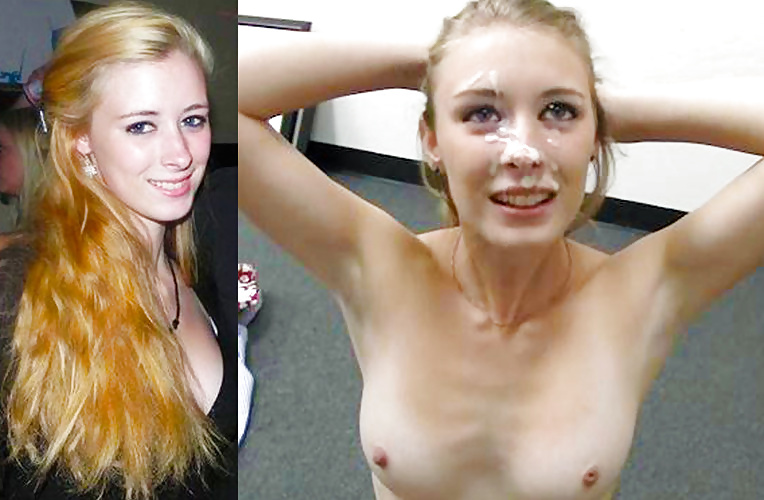 Antes y después de faciales
 #34694786