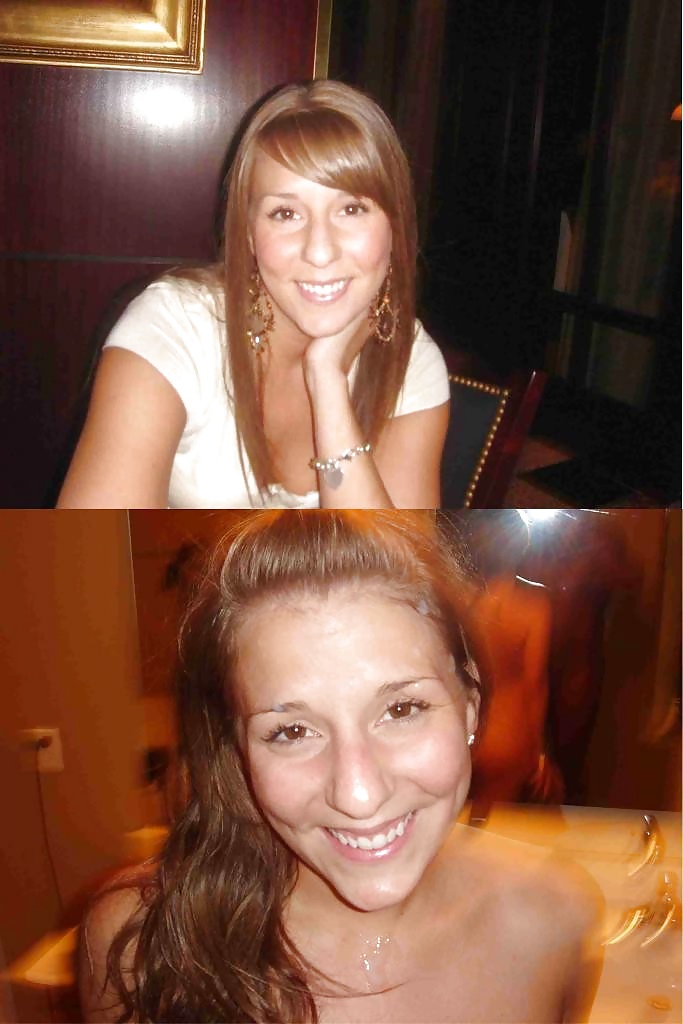 Antes y después de faciales
 #34694821