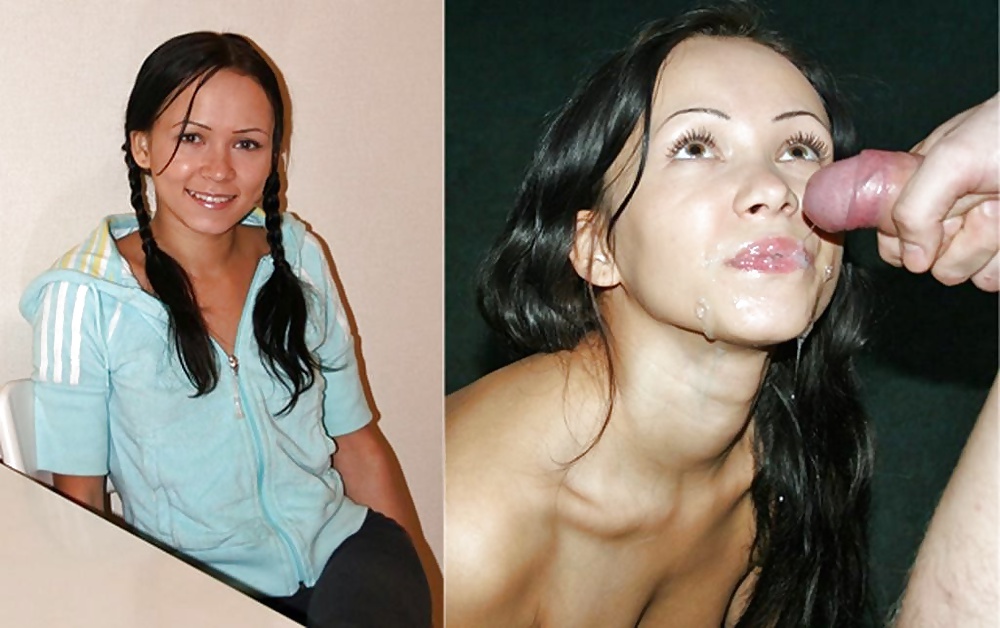 Antes y después de faciales
 #34694828