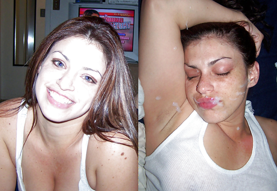 Antes y después de faciales
 #34694969