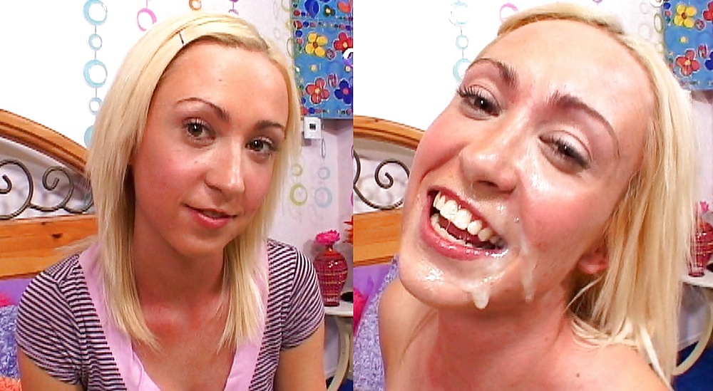 Antes y después de faciales
 #34695019