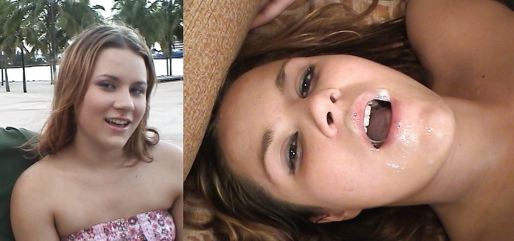 Antes y después de faciales
 #34695034