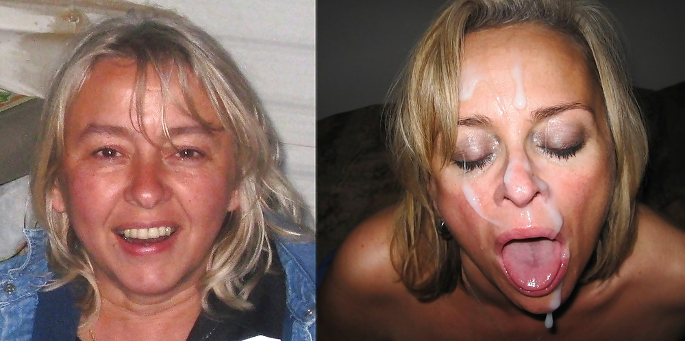Before-After Facials #34695042