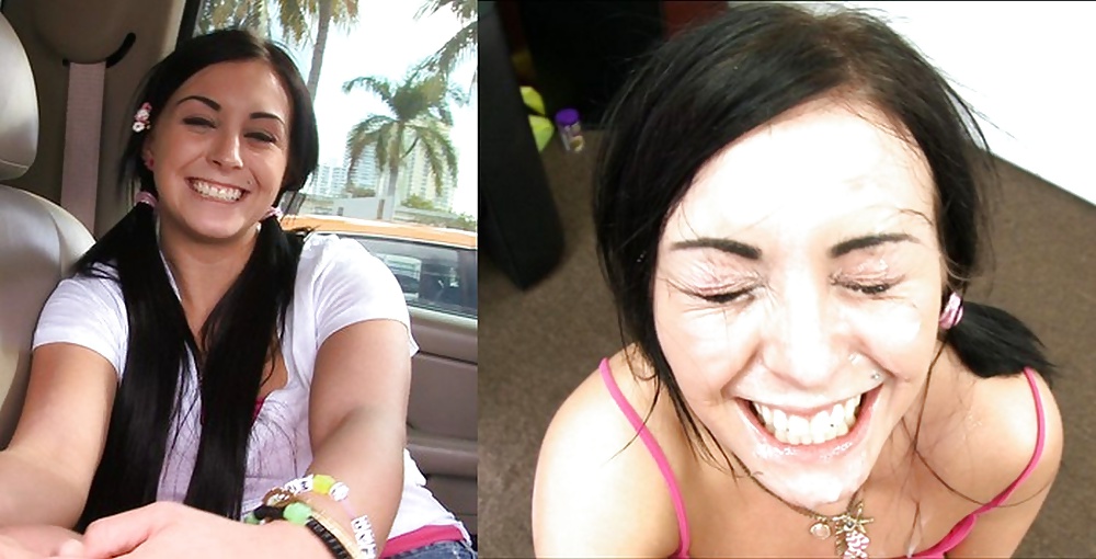 Antes y después de faciales
 #34695057