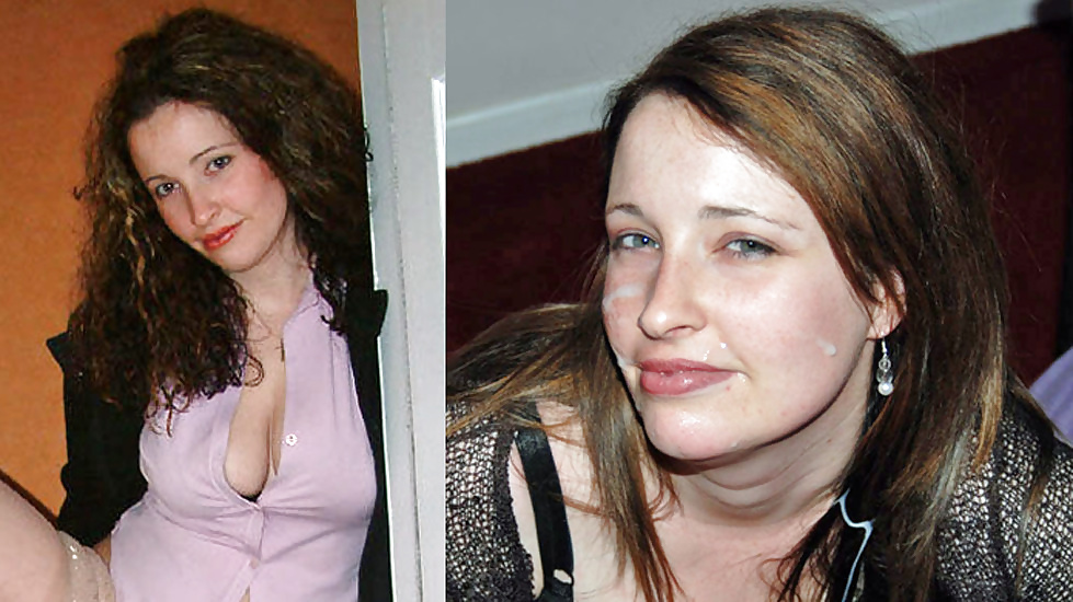 Antes y después de faciales
 #34695060