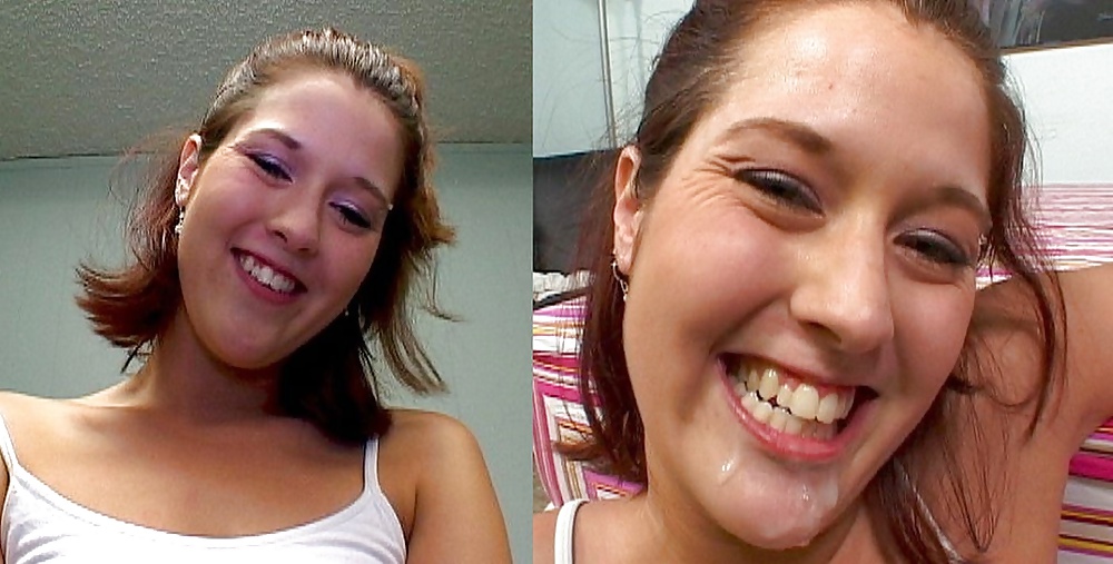Before-After Facials #34695086