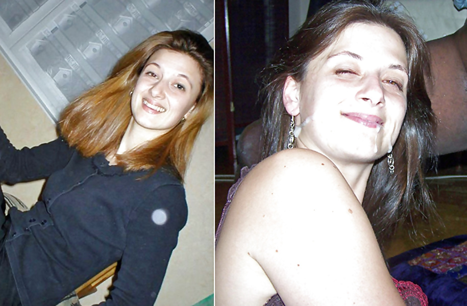 Antes y después de faciales
 #34695097