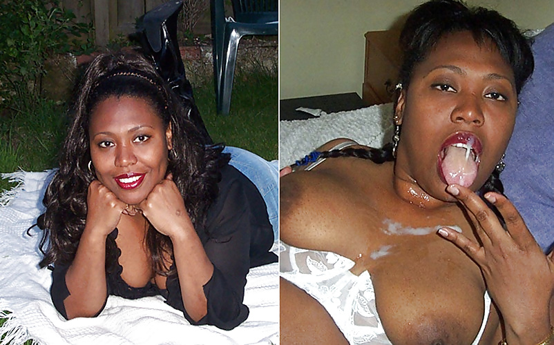 Antes y después de faciales
 #34695112