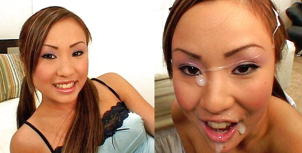 Antes y después de faciales
 #34695129