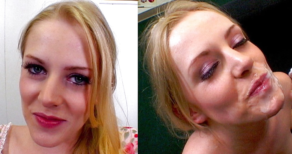 Before-After Facials #34695220