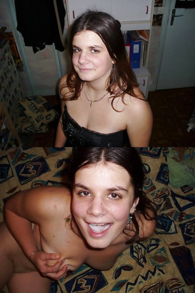 Antes y después de faciales
 #34695257