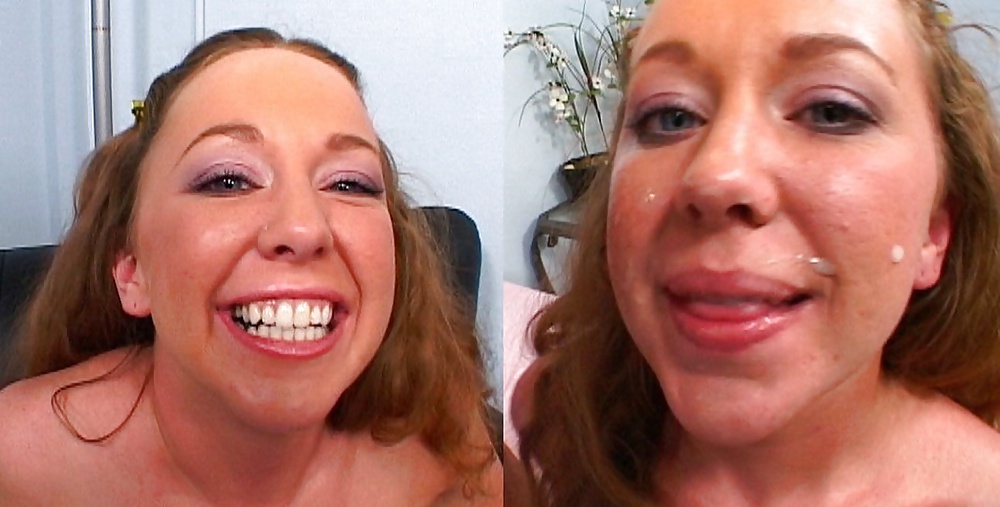 Antes y después de faciales
 #34695279