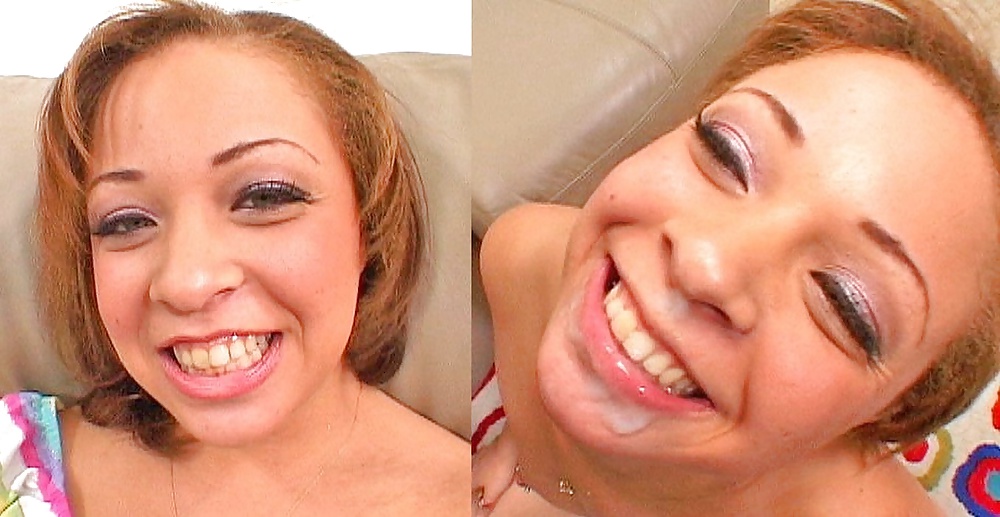 Antes y después de faciales
 #34695308