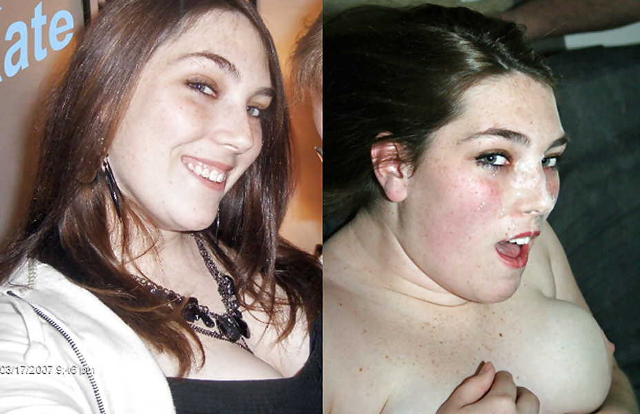 Antes y después de faciales
 #34695398