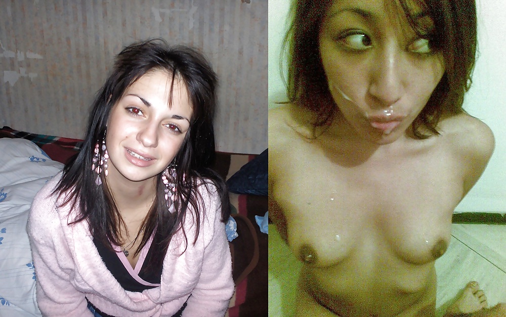 Antes y después de faciales
 #34695401
