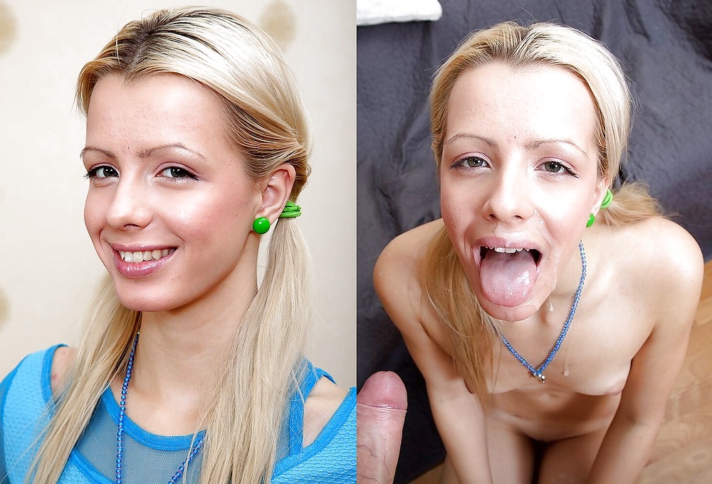 Antes y después de faciales
 #34695448