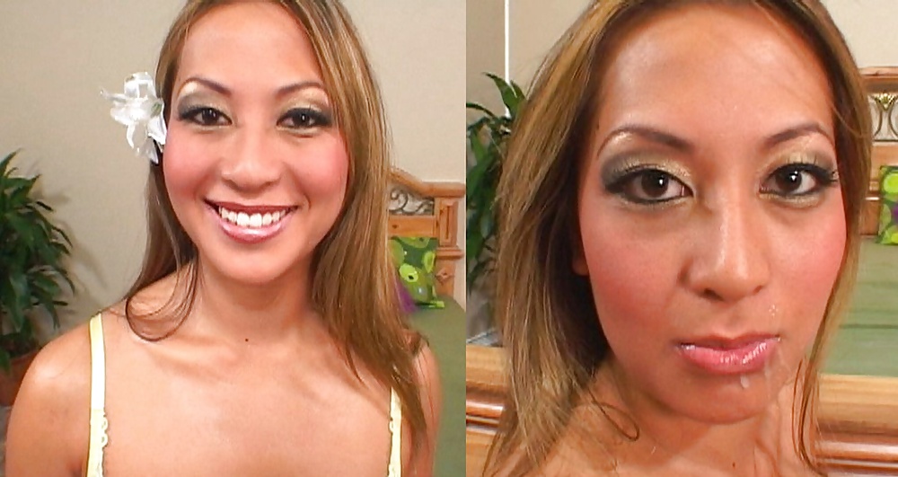 Antes y después de faciales
 #34695494