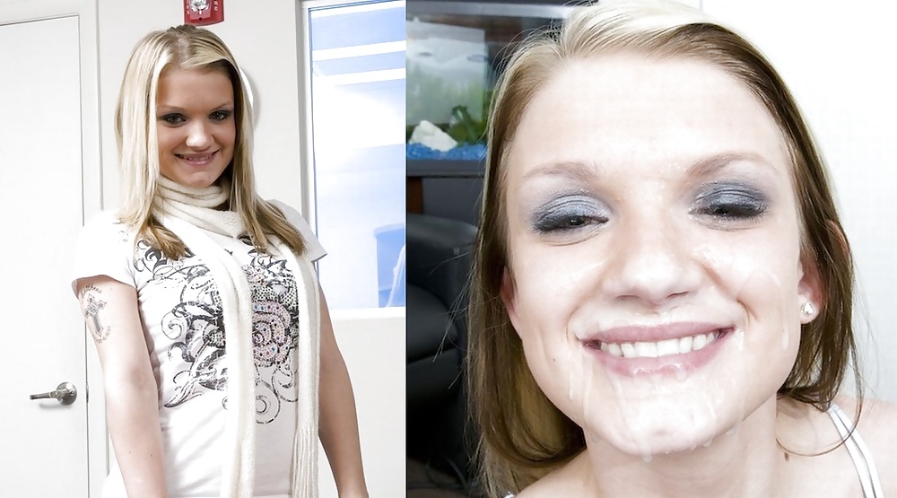 Antes y después de faciales
 #34695645