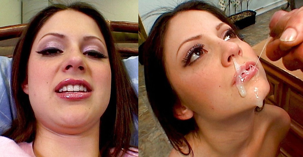 Antes y después de faciales
 #34695649