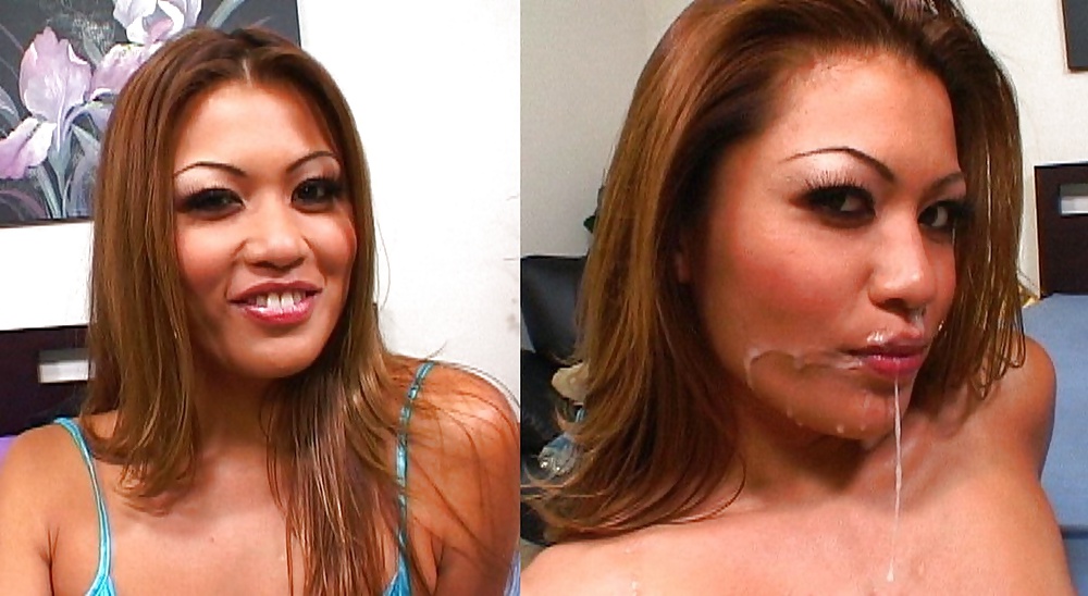 Before-After Facials #34695713