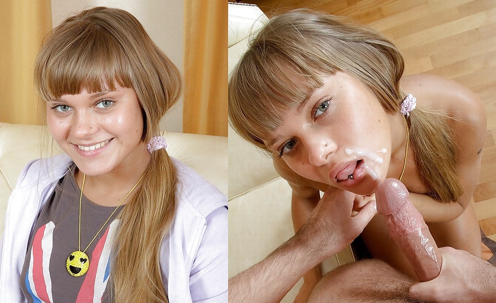 Antes y después de faciales
 #34695727