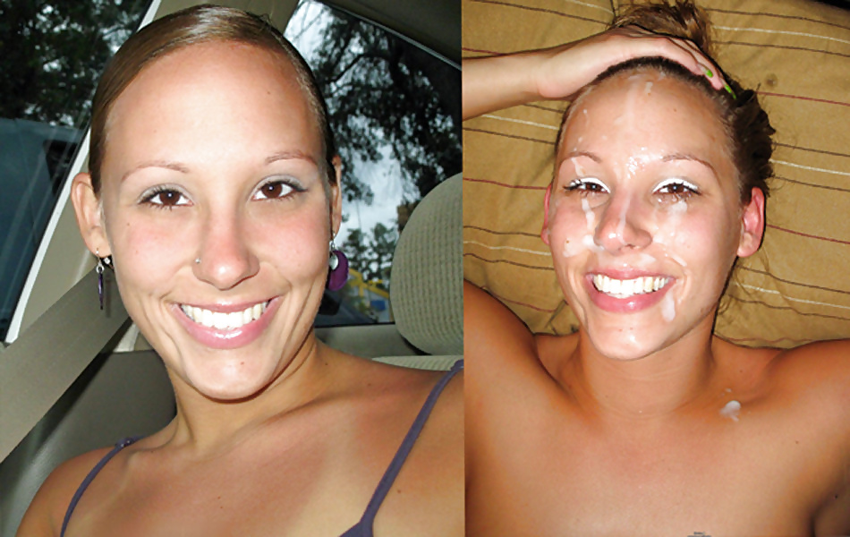 Before-After Facials #34695740