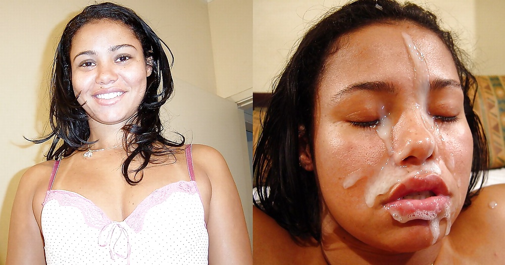 Antes y después de faciales
 #34695756