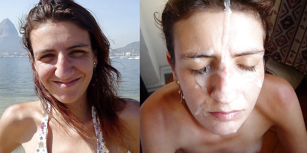 Antes y después de faciales
 #34695803