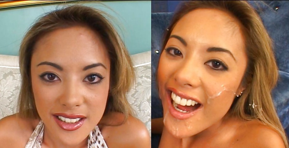 Antes y después de faciales
 #34695809